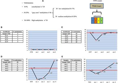 Influence of Intratumor Heterogeneity on the Predictivity of MGMT Gene Promoter Methylation Status in Glioblastoma